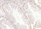 METTL11A Polyclonal Antibody
